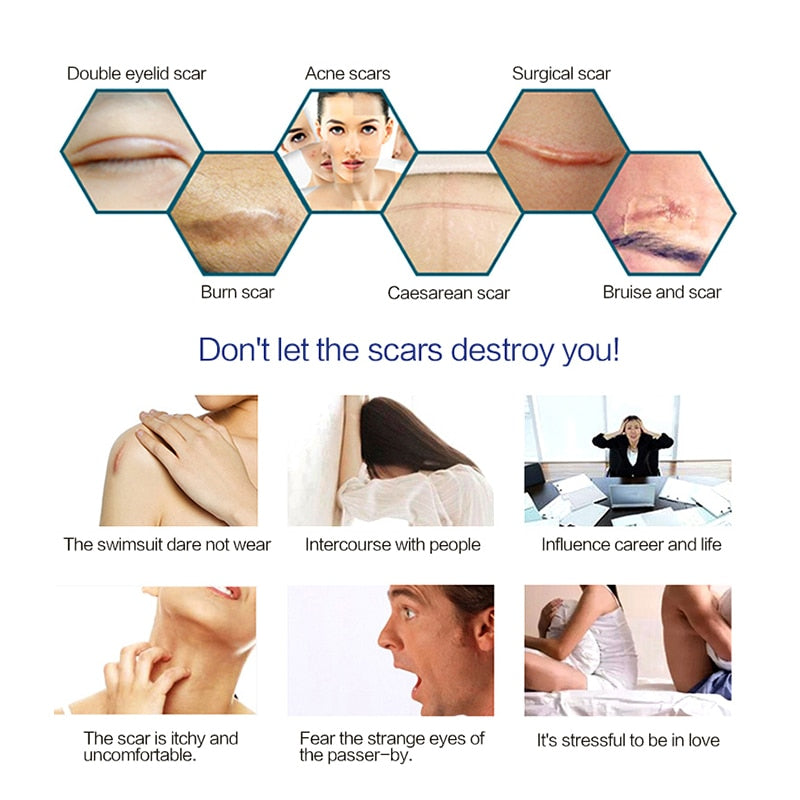 Survival Silicone Gel Patch for Surgery Removal Repair Scar Acne Burn Scar Skin - GiftMaybe